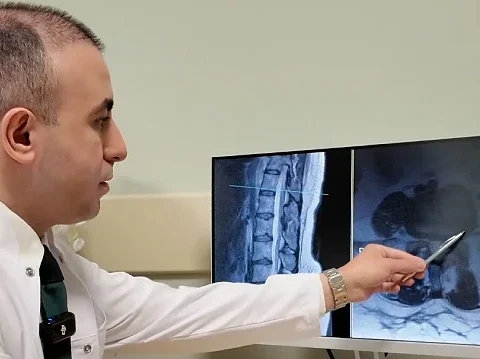 Bel Fıtığına Dikkat: Uzmanlardan Ameliyat Öncesi Önemli Tavsiyeler