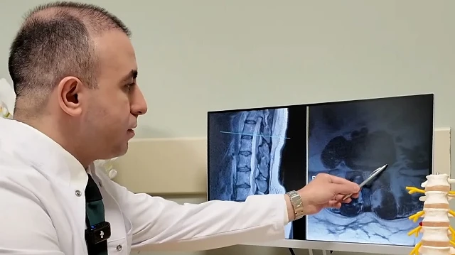 Bel Fıtığına Dikkat: Uzmanlardan Ameliyat Öncesi Önemli Tavsiyeler
